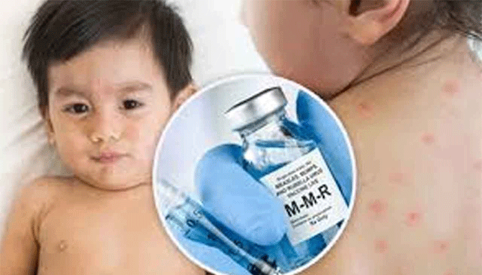 কাল থেকে ৪ সিটিতে হামের টিকা শুরু